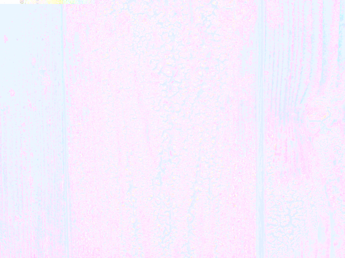 Meyegraine 65